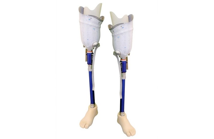 above the knee prosthetic leg
