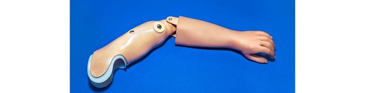 prosthetic arm with moveable elbow