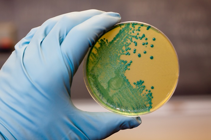 listeria bacteria growing