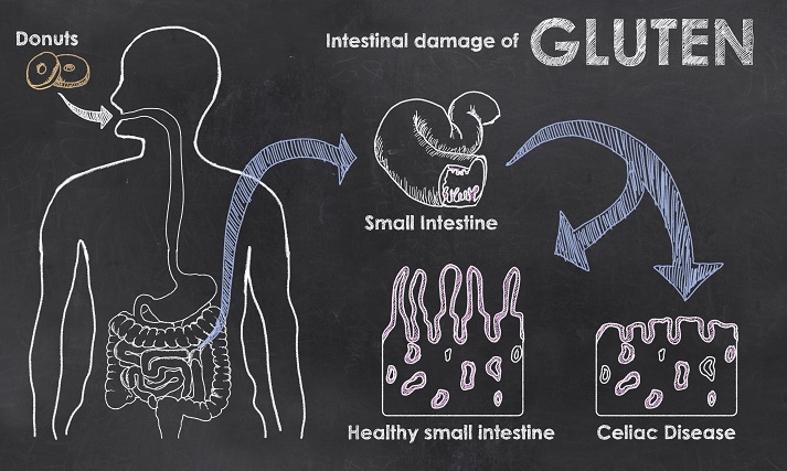 gluten effects