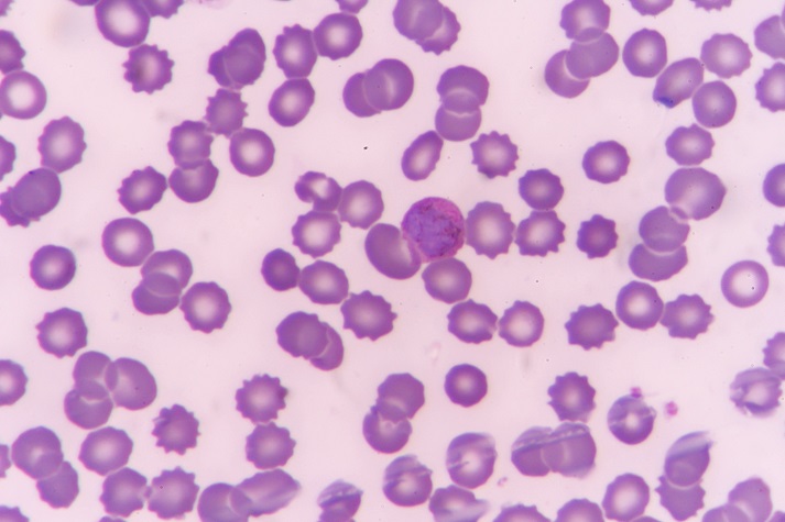 purple cells under a microscope